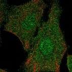 Anti-ELP5 Antibody