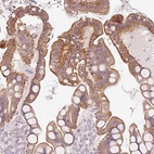 Anti-OSR2 Antibody