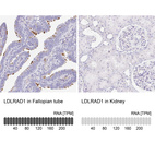 Anti-LDLRAD1 Antibody