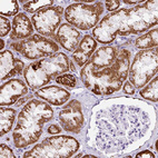 Anti-OGDHL Antibody