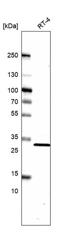 Anti-TMEM81 Antibody