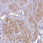 Anti-DIP2A Antibody