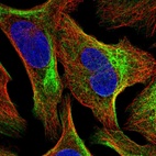 Anti-TMEM81 Antibody