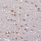 Anti-RPL38 Antibody