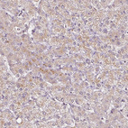 Anti-RPL38 Antibody