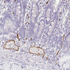 Anti-EHD4 Antibody