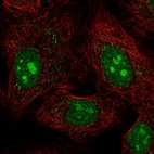 Anti-PCDHAC1 Antibody