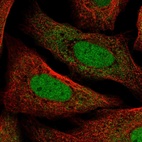 Immunofluorescent staining of human cell line U-2 OS shows localization to nucleoplasm & endoplasmic reticulum.