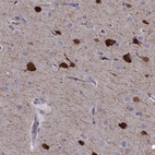 Anti-PCP4L1 Antibody