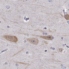 Anti-PCP4L1 Antibody