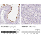 Anti-TMEM150C Antibody