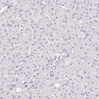 Anti-TMEM150C Antibody