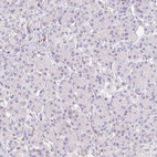 Anti-TMEM150C Antibody