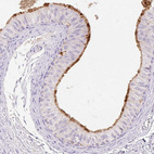 Anti-TMEM150C Antibody