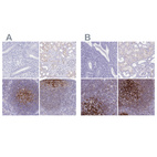 Anti-CR2 Antibody