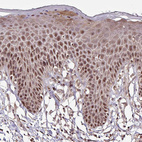 Anti-ITPKC Antibody