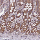 Anti-ITPKC Antibody