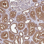 Anti-ITPKC Antibody