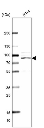 Anti-ITPKC Antibody