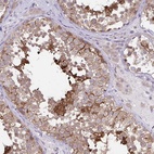 Anti-C17orf105 Antibody