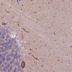 Anti-L3MBTL3 Antibody