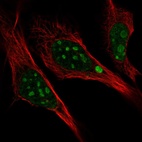 Anti-L3MBTL3 Antibody