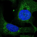 Anti-TEFM Antibody