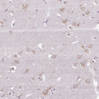 Anti-SYBU Antibody