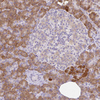 Anti-SYBU Antibody