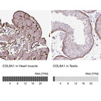 Anti-COL8A1 Antibody