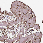 Anti-COL8A1 Antibody