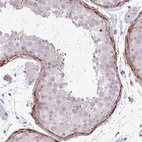 Anti-COL8A1 Antibody