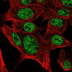 Anti-SCMH1 Antibody