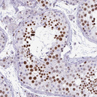 Anti-HMGB2 Antibody