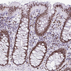 Anti-HMGB2 Antibody