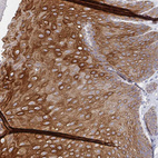 Anti-RHOV Antibody