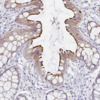 Anti-RHOV Antibody