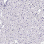 Anti-RHOV Antibody