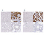 Anti-ZG16B Antibody