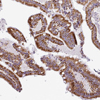 Anti-DPAGT1 Antibody