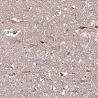 Anti-DPAGT1 Antibody