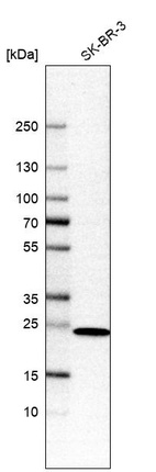 Anti-DHRS2 Antibody