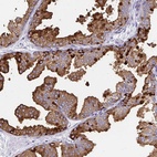 Anti-TEKT4 Antibody