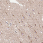 Anti-TM2D3 Antibody