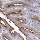 Anti-FER1L6 Antibody