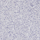 Anti-FER1L6 Antibody