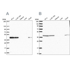 Anti-IDH3B Antibody