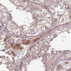 Anti-CCDC93 Antibody