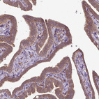 Anti-CCDC93 Antibody