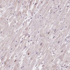 Anti-CCDC138 Antibody